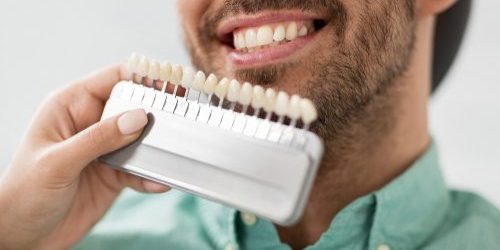 Enhancing Your Smile With Dental Veneers: A Comprehensive Guide dental veneers sterling va Cin Dental Dr. Ali Mualla. Sterling Family & Pediatric Dental. General, Cosmetic, Restorative, Preventative, Family, Pediatric Dentistry dentist in Sterling, VA 20164 Enhancing Your Smile With Dental Veneers: A Comprehensive Guide dental veneers sterling va Cin Dental Dr. Ali Mualla. Sterling Family & Pediatric Dental. General, Cosmetic, Restorative, Preventative, Family, Pediatric Dentistry dentist in Sterling, VA 20164